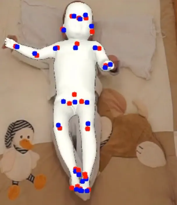 2D human pose keypoints overlaid on an infant's body during video-based motion analysis.